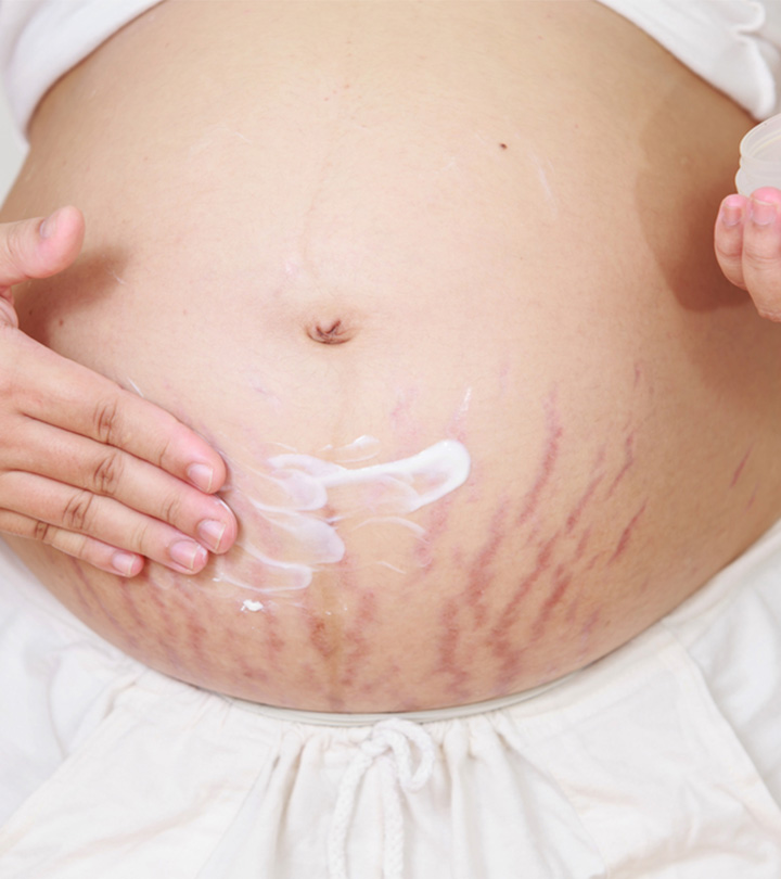 怀孕期间防止妊娠纹的5个有效提示manbet安卓版