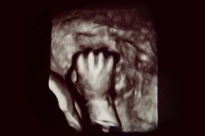 第8周超声波可以检测到胎儿的小手