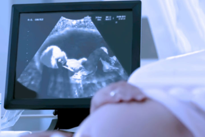 使用超声扫描来确定宝宝的性别
