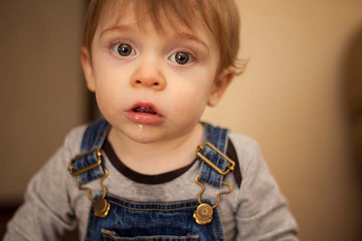 肌肉失调会导致儿童唾液分泌增多