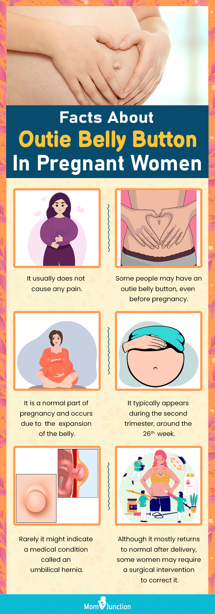 关于孕妇肚脐外露的事实(信息图)