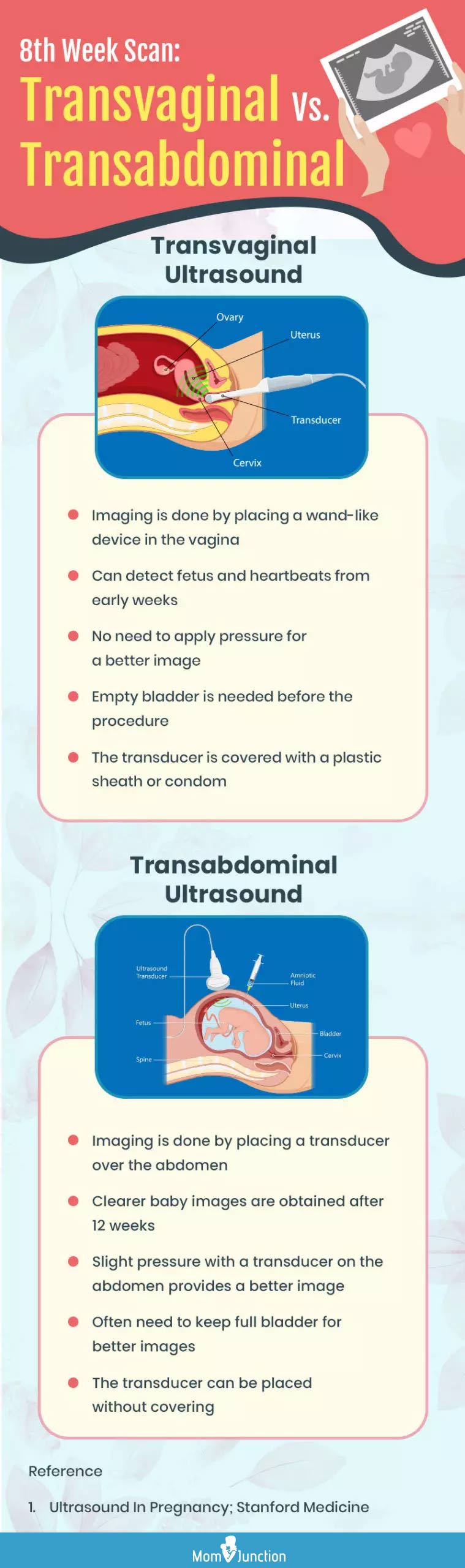 第8周经阴道或经腹部超声检查(信息图)